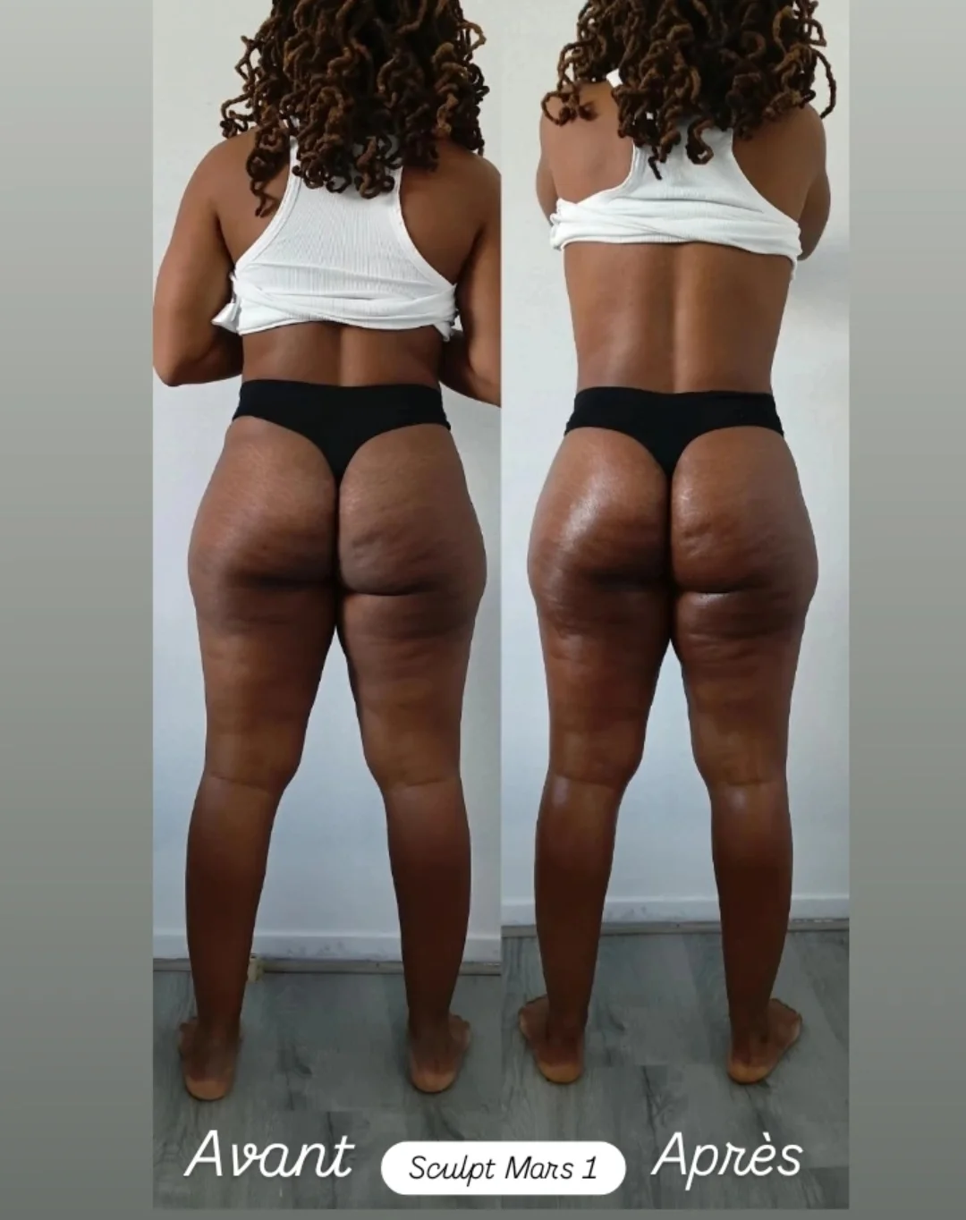 Avant - Massage remodelant